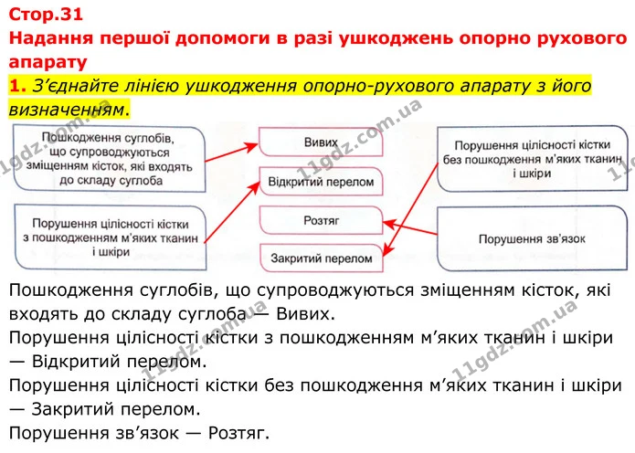 1. З’єднайте лінією ушкодження опорно-рухового апарату з його визначенням. — ГДЗ Робочий зошит Біологія 8 клас Кулініч