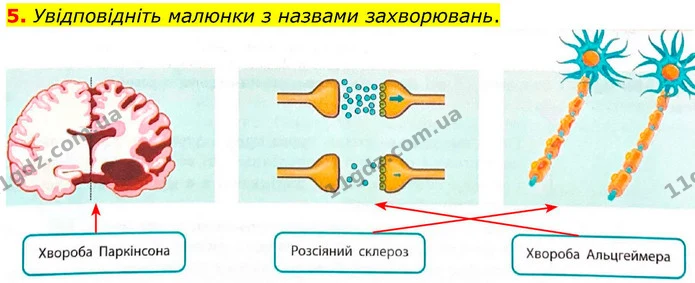 1. Виберіть і позначте V всі правильні твердження щодо класифікації захворювань нервової системи. — частина 5 — ГДЗ Робочий зошит Біологія 8 клас Тагліна (2025)